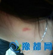 17qкŮǺۆ װl(f)ʲô